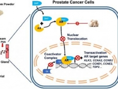 研究發(fā)現(xiàn)白蘑菇提取物能夠抑制小鼠前列腺癌的發(fā)展 ()